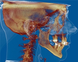 icat airway jaw structure