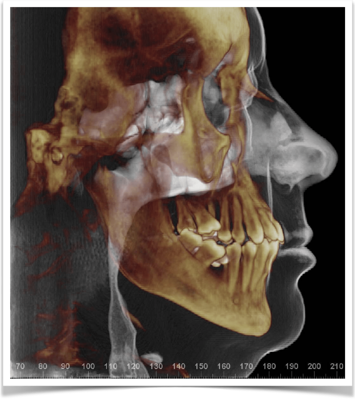 Airway & Bite Alignment