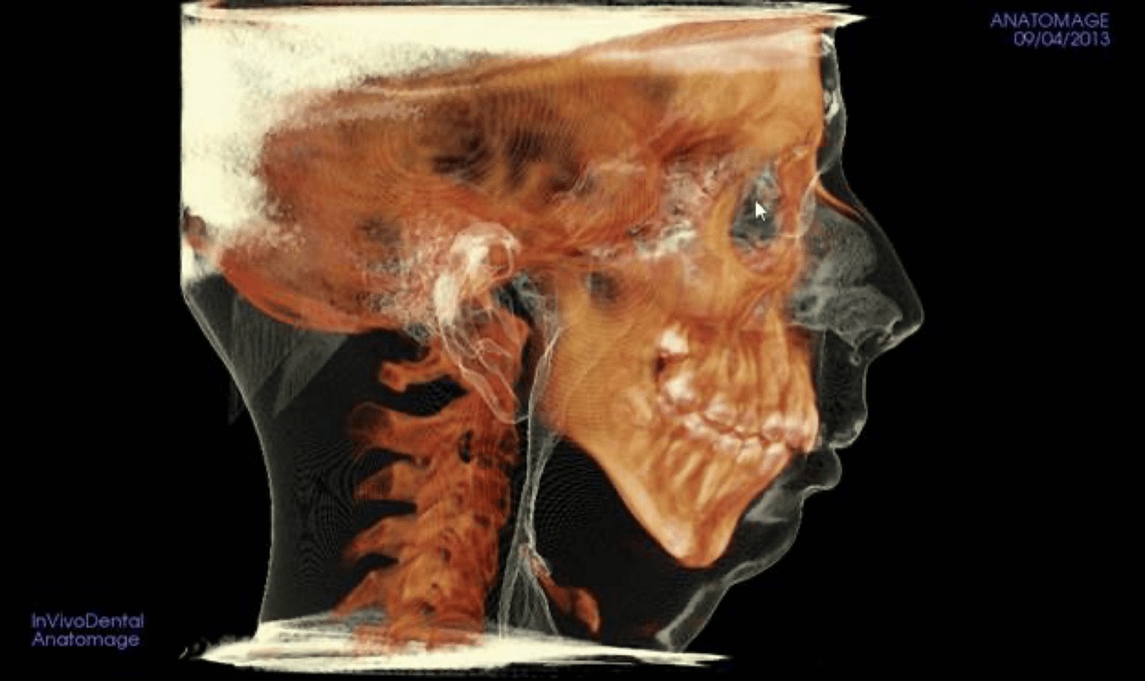 Airway & Bite Alignment